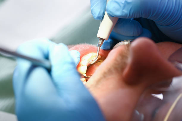 Best Emergency Dentist for Special Needs Patients in Somerville, TN