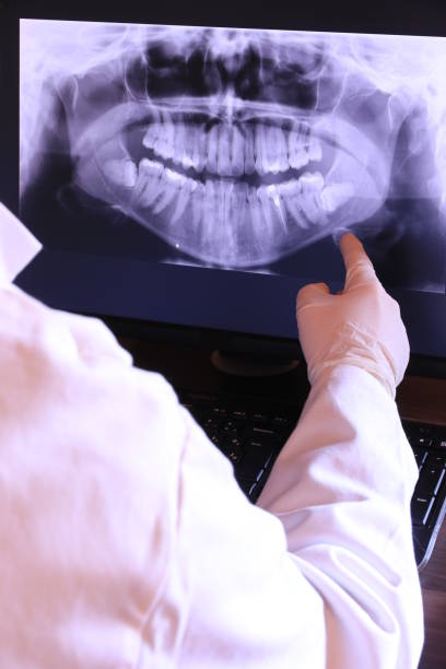 Best Emergency Dentist for Knocked-Out Tooth in Somerville, TN