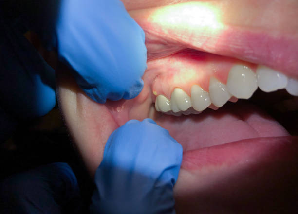 Best Urgent Dental Care for Toothache in Somerville, TN