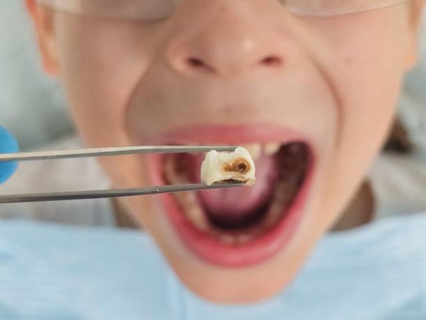 Best Pediatric Emergency Dentist in Somerville, TN